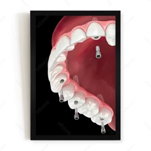 تابلو دکوراتیو دندانپزشکی